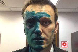 Навальный получил химический ожог глаза в результате нападения с зеленкой в Москве