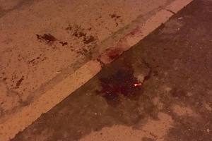 Ночью в Киеве неизвестный напал на мужчину с ножом
