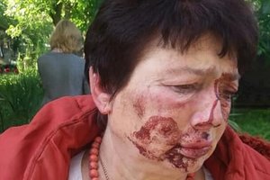 В Коцюбинском жестоко избили главу избирательной комиссии