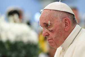 Фото: Папа Римский предстал перед верующими с синяком под глазом и в окровавленной сутане