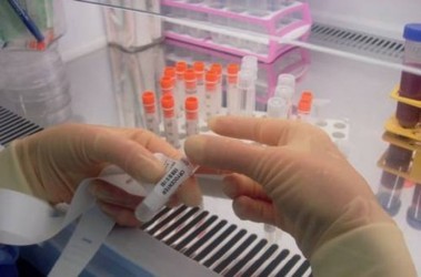 Ученые начинают лучше понимать, как дифференцируют стволовые клетки, фото с сайта cryocenter.ru