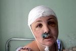 После изнасилования  Крашкова получила инвалидность