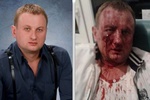 В Ивано-Франковске неизвестные до крови избили депутата