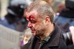 Беспорядки в Харькове начались после того, как кто-то бросил взрывпакет – Кернес