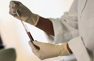 Число погибших от опаснейшего вируса Эбола достигло 887 человек