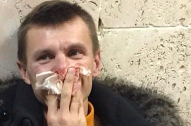 МВД: Задержанный активист Автомайдана сам упал и сломал себе нос