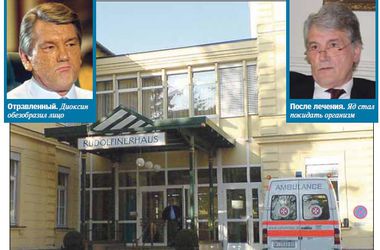 &lt;p&gt;&amp;laquo;Рудольфинерхаус&amp;raquo;. В этой клинике неодократно лечился Виктор Ющенко после отравления&lt;/p&gt;