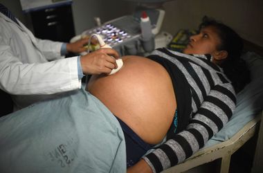 В Испании у беременной женщины обнаружен вирус Зика