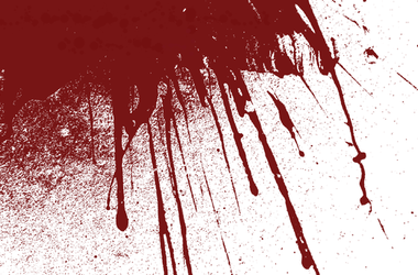 В Херсонской области женщина истекла кровью
