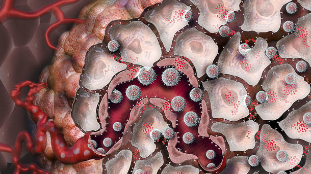 Прорыв в онкологии: наночастицы побеждают рак
