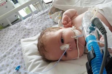 Трехмесячному Артему нужна помощь: с рождения он не может самостоятельно дышать
