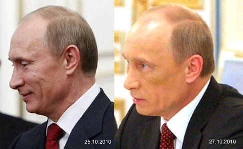 Путин И Ботокс Фото