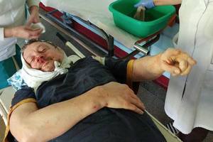 В Кременчуге избили соратника Саакашвили