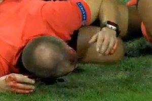 Фанаты разбили голову судье во время матча Лиги Европы в Австрии