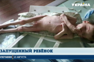 В Кировоградской области врачи ставят на ноги трехлетнего мальчика, доведенного до дистрофии