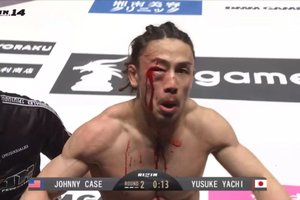 Японский боец получил чудовищную травму глаза